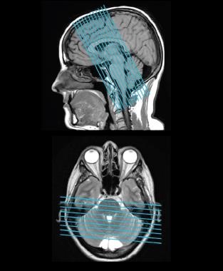 SIGNA™ Artist 128-channel Advanced AIR Edition Package SIGNA™ Artist 128-channel Advanced AIR Edition Package