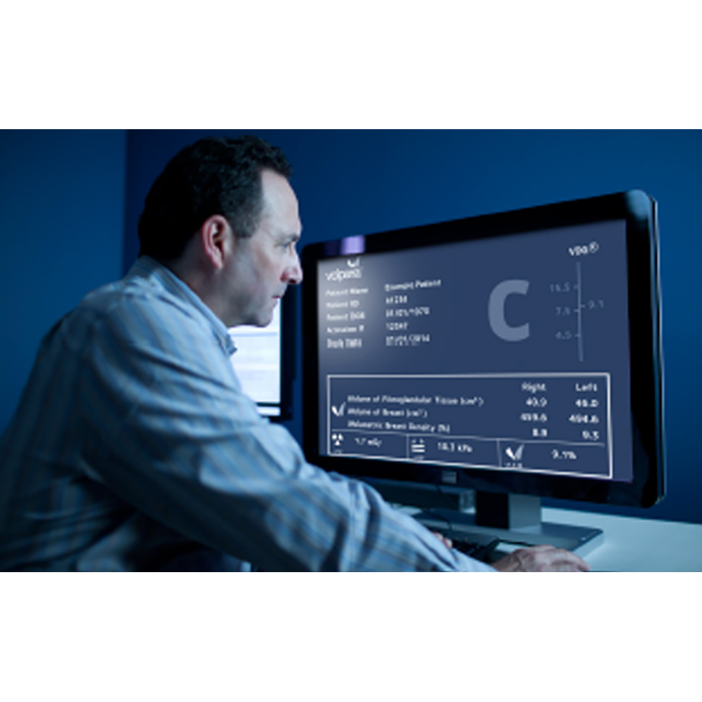 VolparaDensity Software VolparaDensity Software
